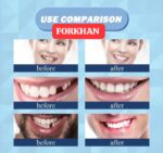 Tooth Repair Glue Resin Resin Denture Adhesive Temporary False Teeth Filling Moldable Solid Glue Tooth Teeth Dentist FeeoiF - Image 3