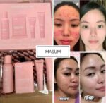 Fairy Skin Derma Facial Set - NEW PACKAGING - Image 2