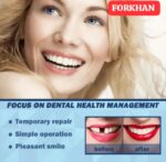 Tooth Repair Glue Resin Resin Denture Adhesive Temporary False Teeth Filling Moldable Solid Glue Tooth Teeth Dentist FeeoiF - Image 5