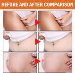 DISAAR Stretch Marks Removal Cream Anti Wrinkle Maternity Skin Repair Scars Mild Nourishing Massage Lotion Pregnancy Stretch Marks Removal Cream 125g DS5402 - Image 4
