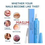 BREYLEE Nail Treatment Serum Feet Care Essence Fungal Nail Foot Repair Removal Gel - Image 3