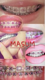 Professional DIY Orthodontic Braces Training Kit – Multi-Color Metal Brackets & Archwire Set - Image 4